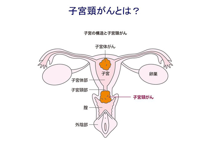 uterus_contents